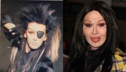 celeb-surgery-pete-burns-plastic-surgery-before-and-after.jpg